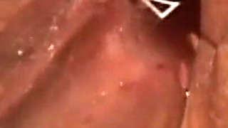Doctor Thoroughly Inspects Pregnant MILF's Dripping Creampie