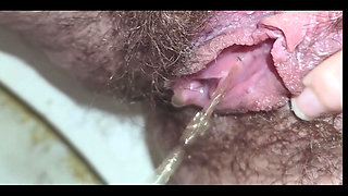 Glimpse the Urethra as It Opens When the Stream of Pee Comes Out