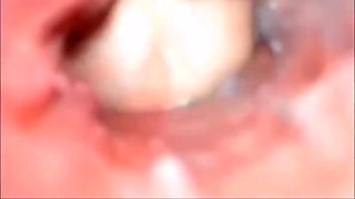 Pittsburgh Oral, Anal, And Vaginal