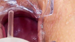 Cervical exam of chubby young blonde Cayla Lyons by 2 doctors