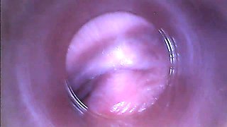 Close up anal toying