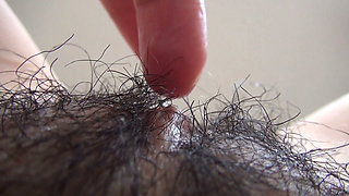 The Mound of the Clitoris