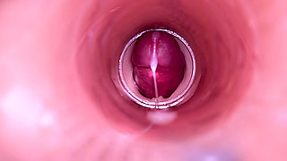 Female Insemination - Internal Camera Captures Deep Male Ejaculation